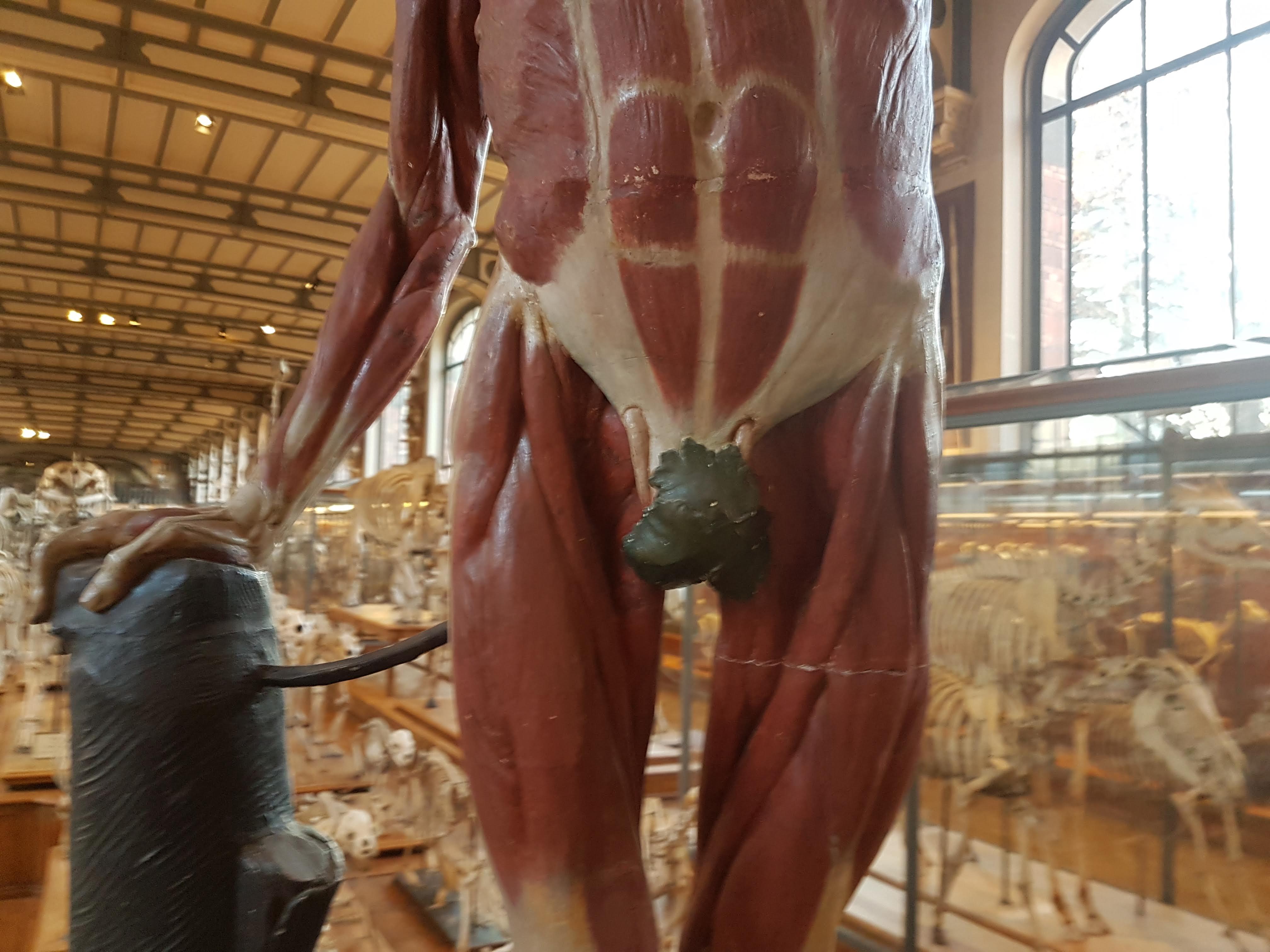 pathology | What's In John's Freezer?